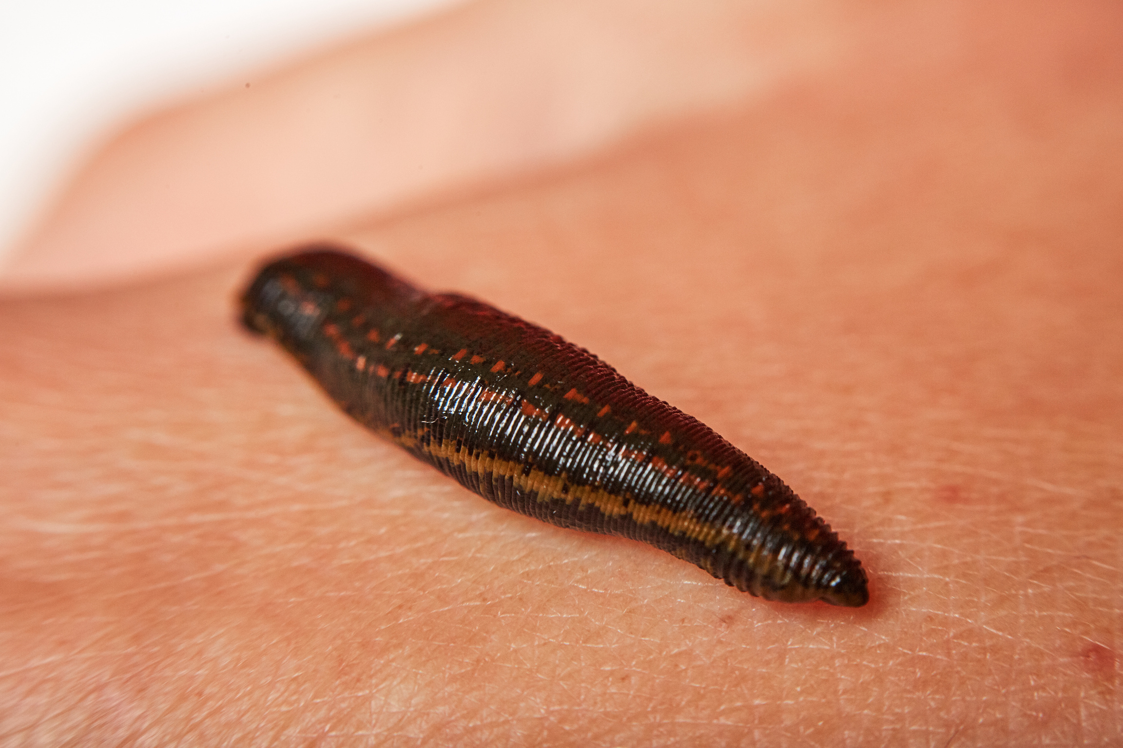 Leech on man's hand